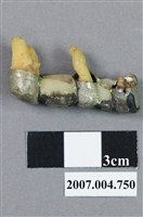 藏品(牙科臼齒及犬齒齒模)的圖片