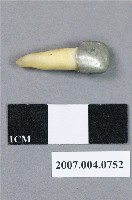 藏品(牙科門牙齒模)的圖片