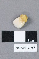 藏品(牙科門牙齒模)的圖片