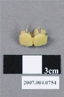 藏品(牙科門牙齒模)的圖片