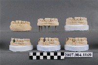 藏品(合金牙冠和瓷牙冠製作分解模型)的圖片