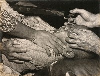 藏品(看病小孩)的圖片