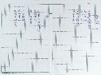 藏品(岩上詩：掌紋、樹)的圖片
