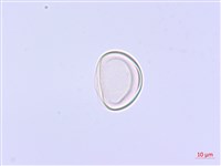 藏品(過溝菜蕨)的圖片