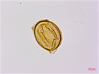 藏品(烏毛蕨)的圖片