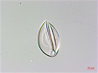 藏品(陰地三叉蕨)的圖片