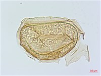 藏品(大葉雙蓋蕨、大羽雙蓋蕨)的圖片
