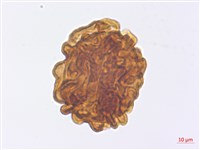 藏品(腫足蕨)的圖片