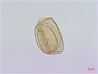 藏品(細鱗雙蓋蕨、褐鱗雙蓋蕨)的圖片