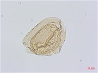 藏品(細鱗雙蓋蕨、褐鱗雙蓋蕨)的圖片