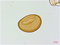 藏品(假軸果蹄蓋蕨、毛軸蹄蓋蕨)的圖片