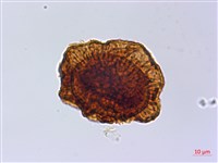 藏品(腫足蕨)的圖片