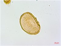 藏品(姬蹄蓋蕨、溪谷蹄蓋蕨)的圖片