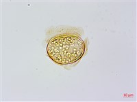 藏品(烏毛蕨)的圖片