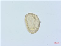 藏品(廣葉鋸齒雙蓋蕨)的圖片