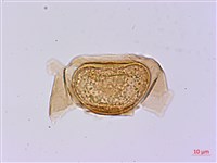 藏品(長苞雙蓋蕨、鱗柄雙蓋蕨)的圖片