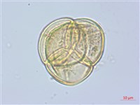 藏品(斑紋鹿蹄草)的圖片