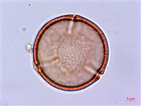 藏品(長刺酸模)的圖片