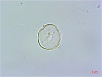 藏品(釣狀冷水花)的圖片