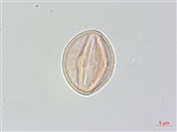 藏品(中國旌節花)的圖片