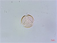 藏品(西印度櫻桃)的圖片