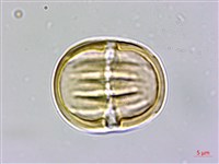 藏品(圓錐花遠志)的圖片