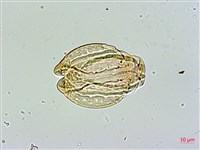 藏品(棋盤腳樹)的圖片