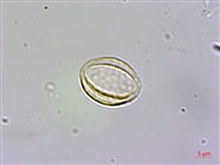 藏品(長行天南星、雷公統)的圖片