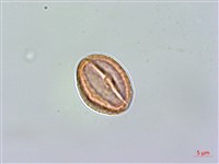 藏品(小連翹)的圖片