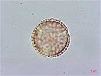 藏品(雞冠滇丁香)的圖片