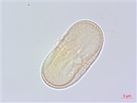 藏品(雪珠花)的圖片