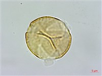 藏品(臺灣金絲桃)的圖片