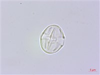 藏品(響鈴豆)的圖片