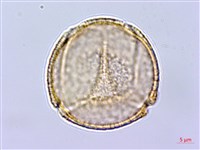 藏品(小果酸模)的圖片