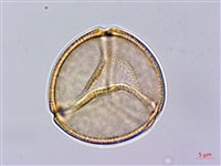 藏品(齒果酸模)的圖片