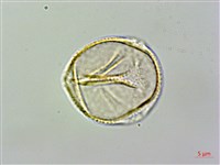 藏品(雙心皮草、光萼唇柱苣苔)的圖片