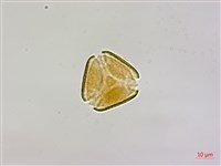 藏品(椆樹桑寄生, 大葉榿寄生)的圖片