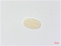 藏品(毒芹)的圖片