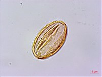 藏品(玉山金梅)的圖片