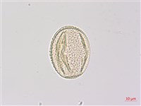 藏品(三葉山香圓)的圖片