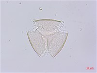 藏品(秤錘樹)的圖片