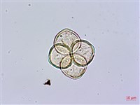 藏品(砲彈樹)的圖片