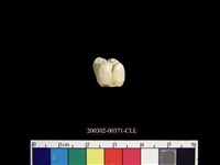 藏品(人齒)的圖片