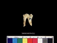 藏品(人齒)的圖片