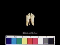 藏品(人齒)的圖片