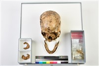 藏品(老年女性頭骨)的圖片