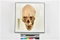 藏品(成人頭骨)的圖片