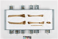 藏品(成人下肢骨)的圖片