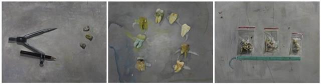 牙本質系列藏品圖，第1張