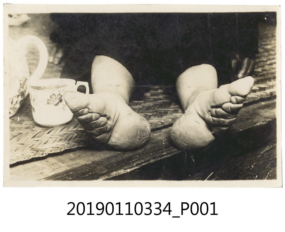 三寸金蓮照片 (共3張)